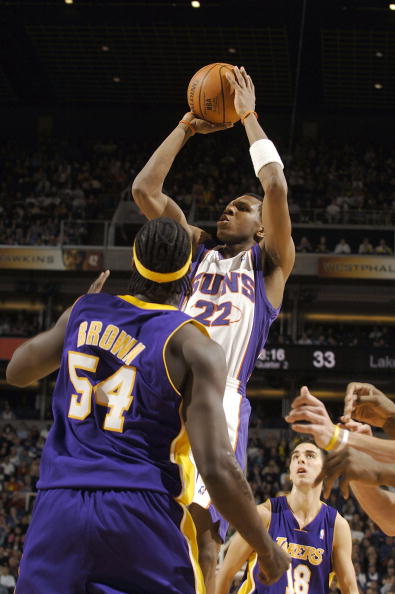 左眼结膜炎 左眼结膜炎